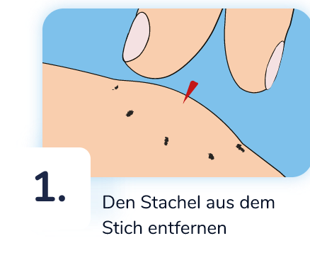 Den Stachel aus dem Stich entfernen